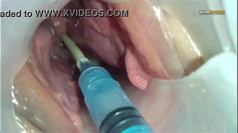 Sperm Injected Into The Uterus Of The Wife Of Others Xxx Mobile Porno Videos And Movies