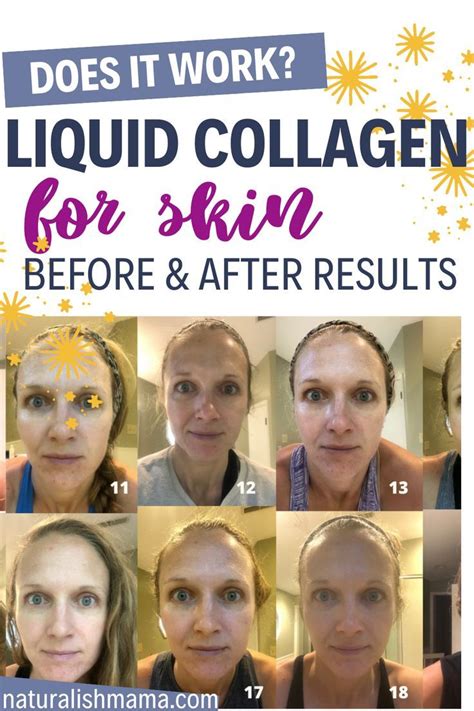 My Collagen Before and After Results! | Skin care tips, Skin care ...