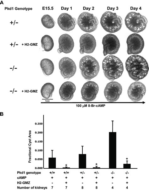 H Gamendazole H Gmz Treatment Reduces The Cyst Burden In