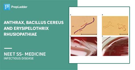 Anthrax Bacillus Cereus And Erysipelothrix Rhusiopathiae