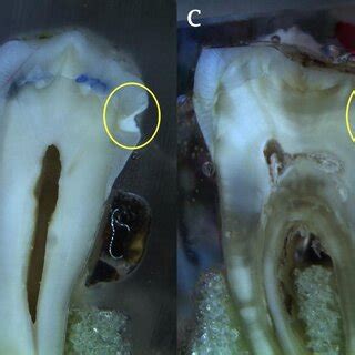 images  teeth sections   light microscope