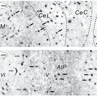 Photomicrographs Of Fos Immunoreactive Fos Ir And Nadph Diaphorase