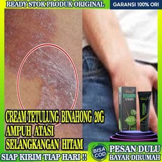 Jual Salep Selangkangan Hitam Dan Gatal Salep Obat Gatal Jamur