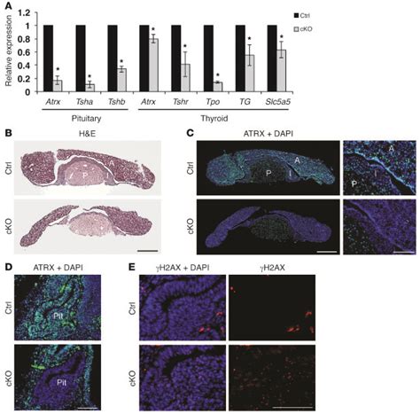 Jci Atrx Deficiency Induces Telomere Dysfunction Endocrine Defects