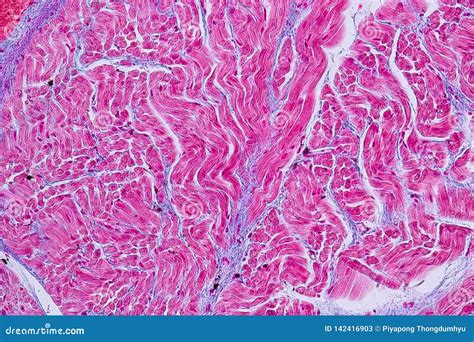 Tissu Histologique De Muscle Cardiaque T Moin Sous Le Microscope Image