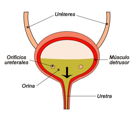 Vejiga Hiperactiva Cl Nica Tra A