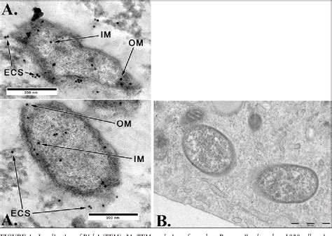 Rickettsia Rickettsii Microscope