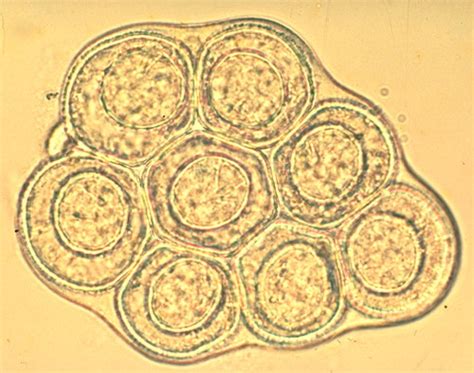 Dipylidium Proglottids