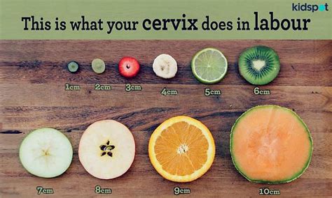 Cervix Dilation Chart The Stages Of Labor In Pictures 48 Off