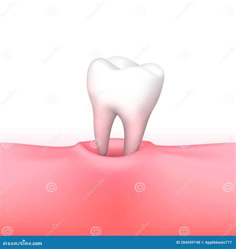 Tooth Loss on White Background Stock Vector - Illustration of signboard
