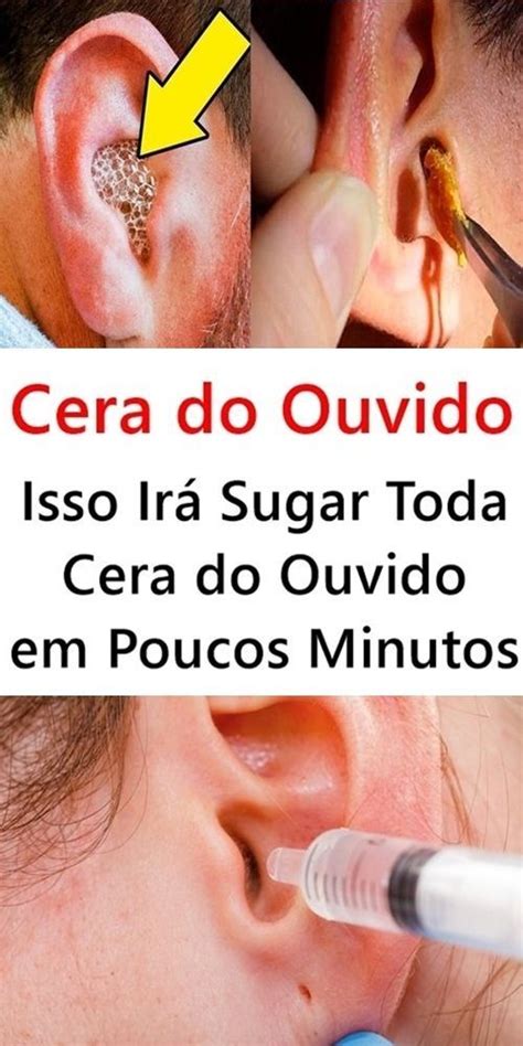 Cera no ouvido - Faça apenas isso para remover a cera em minutos ...