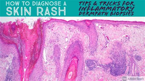 How To Diagnose Skin Rash Tips And Tricks For Inflammatory Dermpath Skin