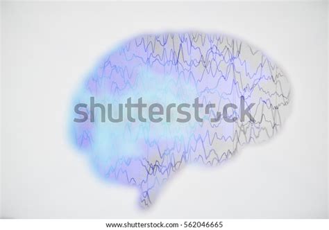 Brain Wave On Electroencephalogram Eeg Epilepsy Stock Photo (Edit Now ...