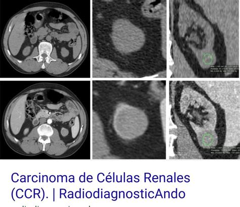 Pin By Liznel Feliberty On Imagenes De Ct Scan Y Mri Ct Scan Mri