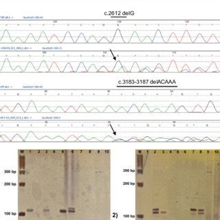 A Specific Mutations In The APC Gene Of FAP A Sequencing Shows The