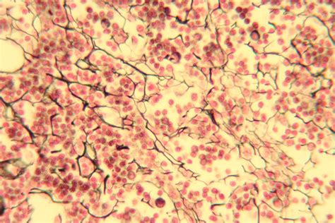 Reticular Lymph Node 400X 4