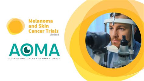 Melanoma And Skin Cancer Trials Australasian Ocular Melanoma Alliance Youtube