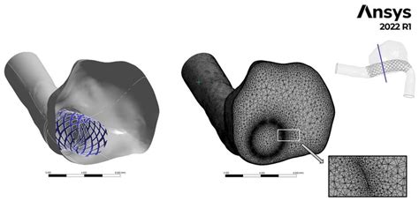 Fluids Free Full Text Hemodynamic Investigation Of The Flow