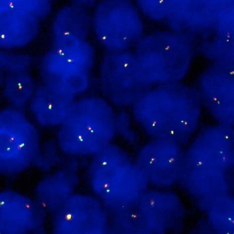 Representative Example Of Interphase Fish Finding Using The Ntrk Probe