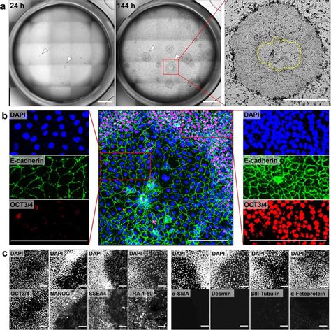 Characterization Of Hipsc Colonies Exhibiting Deviation In Culture With