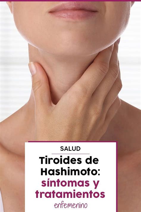 Tiroides De Hashimoto S Ntomas Consecuencias Y Tratamiento Tiroides