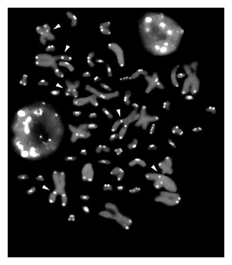 In Situ Hybridization Of Digoxigenin Labeled TTAGGG N Probe Onto T