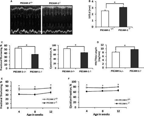 PECAM1 Mice Have Increased Chamber Size With Systolic And Diastolic