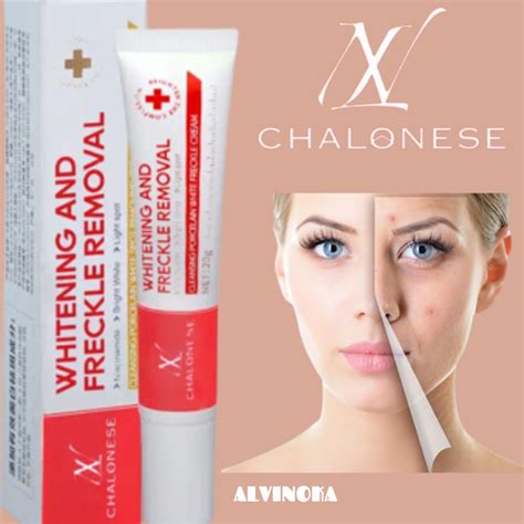 Jual CHALONESE Cream WHITENING AND FRECKLE REMOVAL MENGHILANGKAN BEKAS