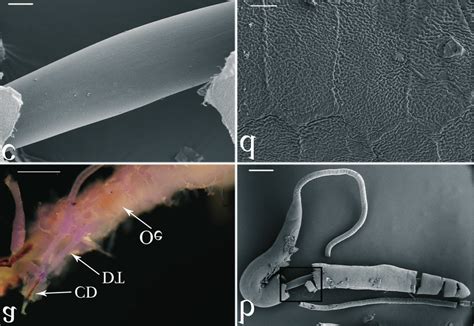 Silk Glands Of Fifth Instar Larvae Of Lymantria Dispar A Light