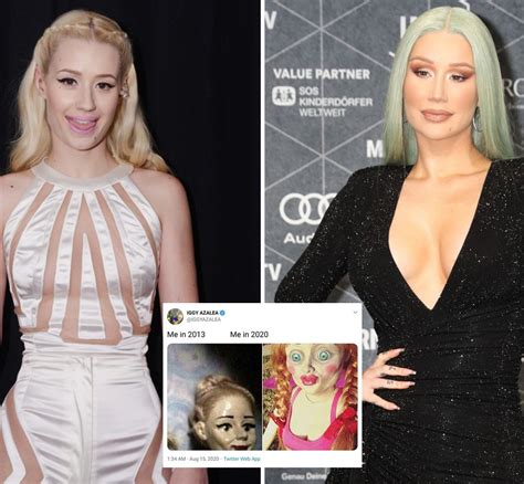 Iggy Azalea Before And After Fame