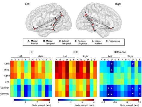 Subjective Cognitive Decline Detected By The Oscillatory Connectivity