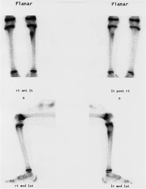 MSK Radiology 4U