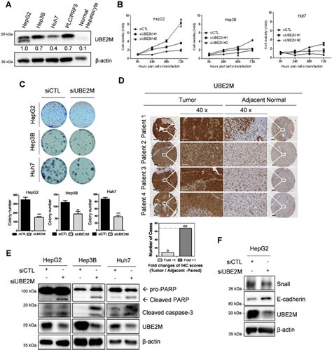 Figure 1 From Ube2m Drives Hepatocellular Cancer Progression As A P53