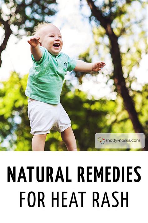 Natural Remedies for Heat Rash in Children