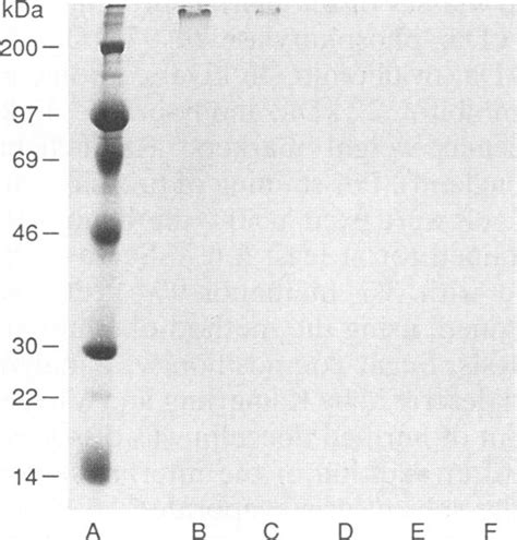 SDS PAGE Of Purified Flocculin Isolated From Brewer S Yeast Strain