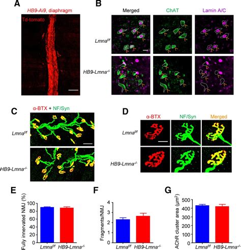 A Role Of Lamin A C In Preventing Neuromuscular Junction Decline In