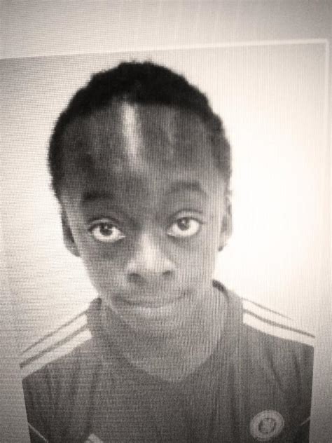 Biggest Forehead In The World