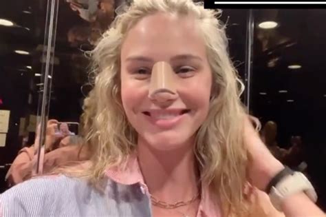 Meghan King Shares Recovery Photos After Nose Boob Jobs