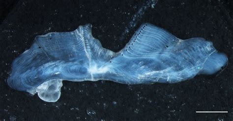 Transverse Section Of A Right Sagittal Otolith Of An Epinephelus