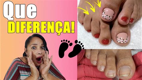 Cutilagem Dos PÉs E EsmaltaÇÃo TransformaÇÃo Incrivel 😱😱😱 Youtube