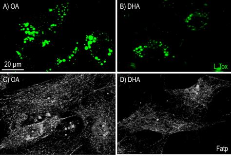 Imaging Of Lipid Droplets By Fluorescence Microscopy Stained With