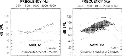 Effects Of Compression On Speech Acoustics Intelligibility And Sound Quality Pamela E Souza