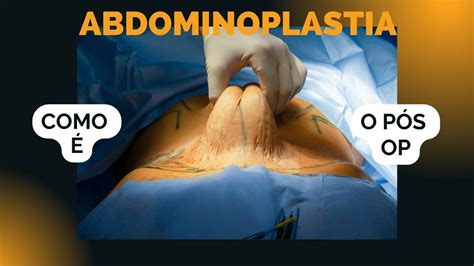 Como É O Pós Operatório Da Abdominoplastia Youtube