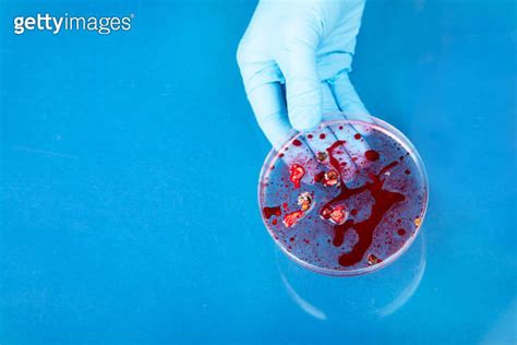 Hand In Blue Glove Holding Petri Dish With Bacterium Microbiology