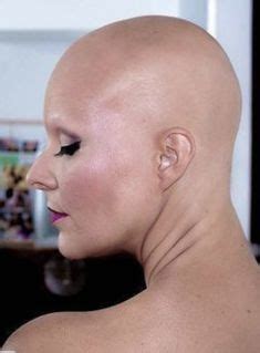 Alopecia Ideen In Glatze Kahle Frauen Rasieren