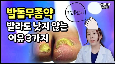 발톱무좀약 발라도 효과없는 이유 3가지 Youtube