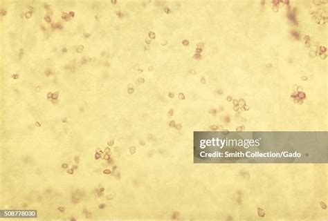 Yeast Under Microscope Photos and Premium High Res Pictures - Getty Images