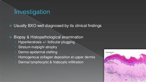 Balanitis Xerotica Obliterans Bxo Penile Lichen Sclerosus