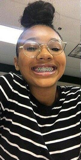 Pin On Braceface Cute Braces Braces Girls Braces Colors