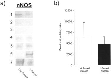 A Expression Of Neuronal Nitric Oxide Synthase Nnos And B